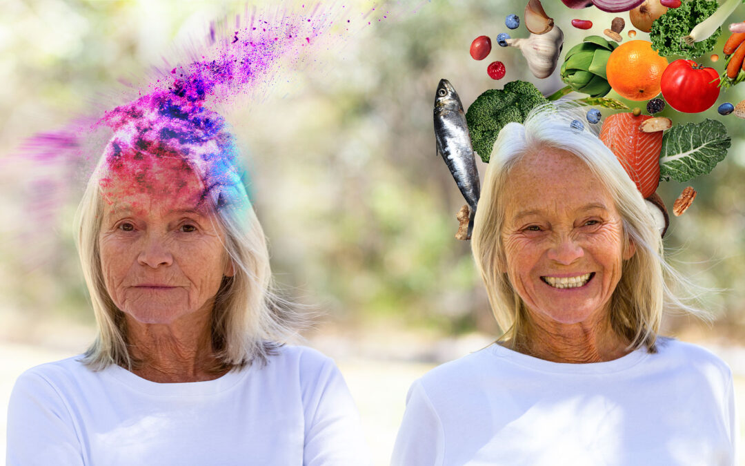 Maladie d'Alzheimer : les nutriments bon marché surclassent le dernier médicament