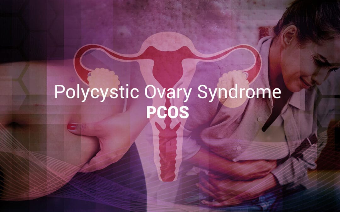 PCOS beyond reproduction: the metabolic roots of an hormonal disorder